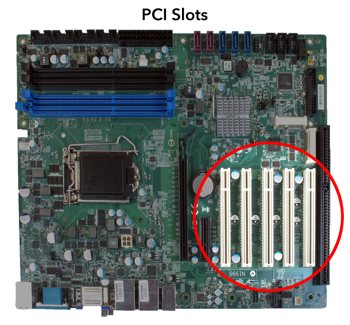 What Is A Heart Pci